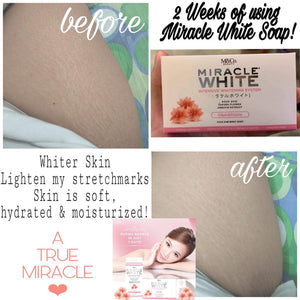 Miracle White Advanced Whitening Soap