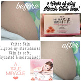 Miracle White Advanced Whitening Soap